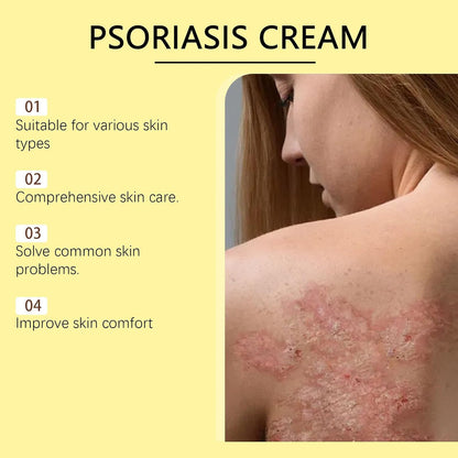 Psoriasis Cream