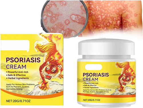 Psoriasis Cream